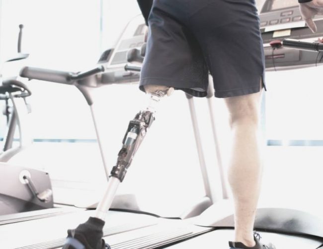 髖部動力外骨骼，幫助膝上截肢患者行走